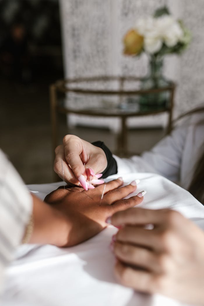 home-hero A focused shot of a hand receiving acupuncture therapy, highlighting traditional healing methods.